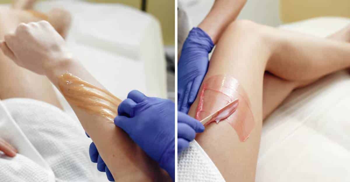 Comparison of sugaring vs waxing hair removal methods.