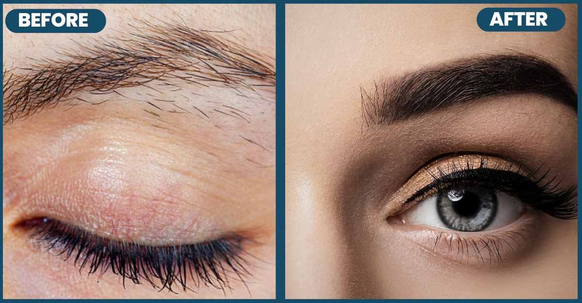 Before and after images showing results of eyebrow sugaring treatment