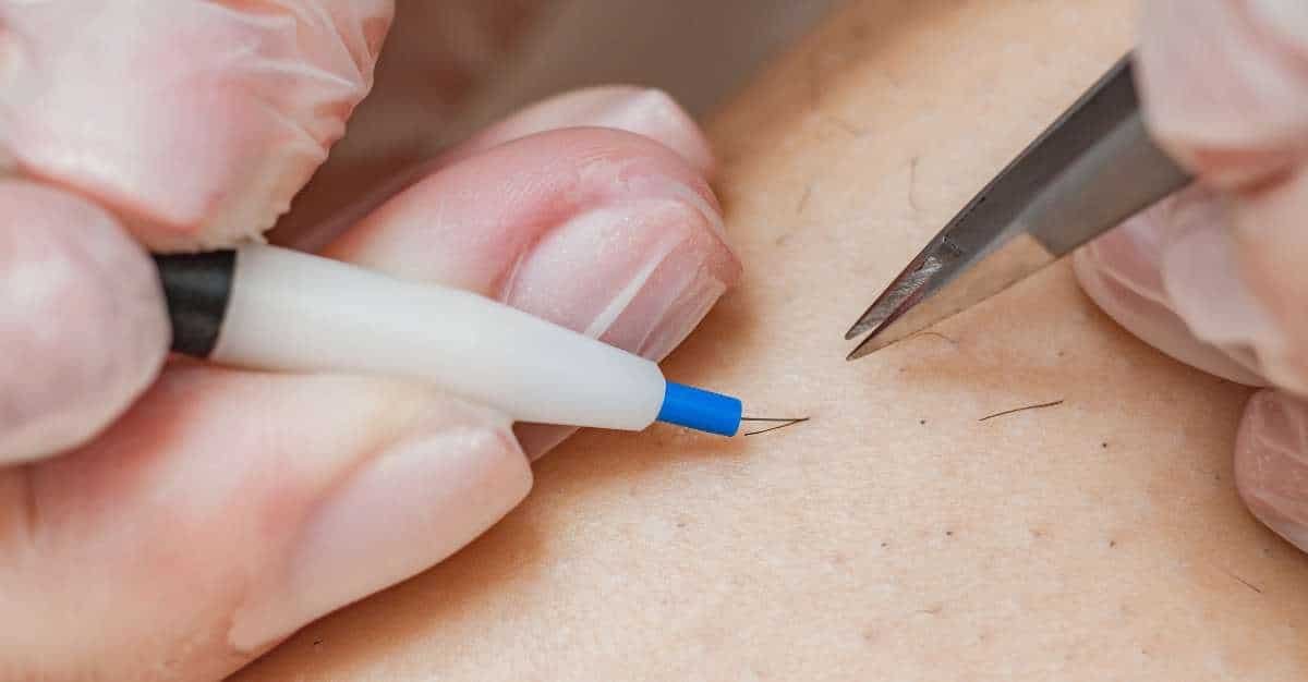 Electrolysis