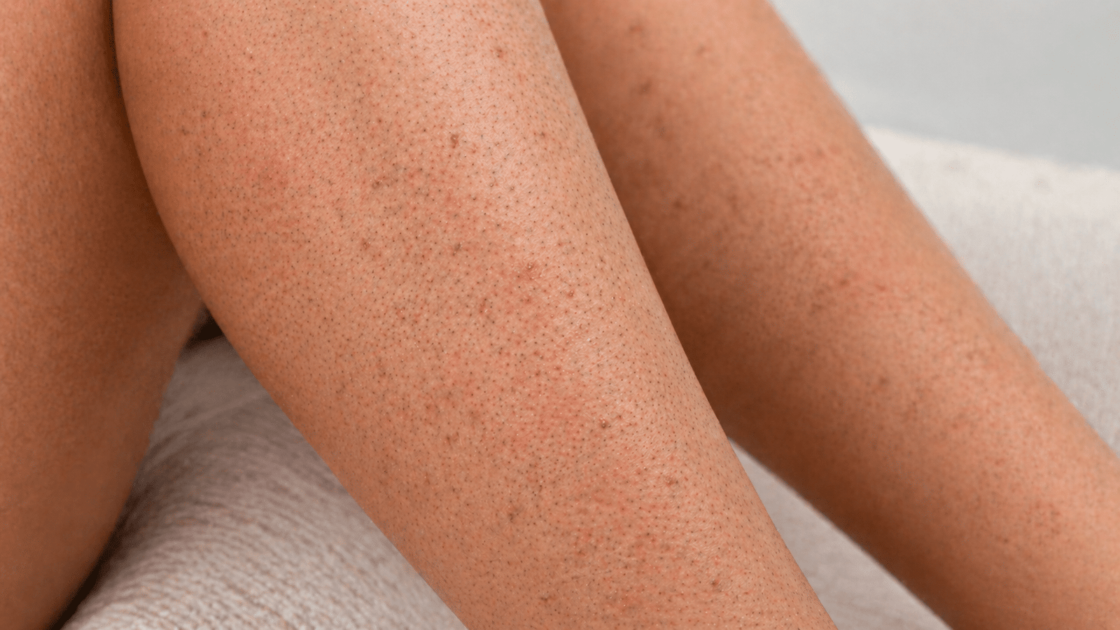 Common Symptoms of Strawberry Legs on Skin
