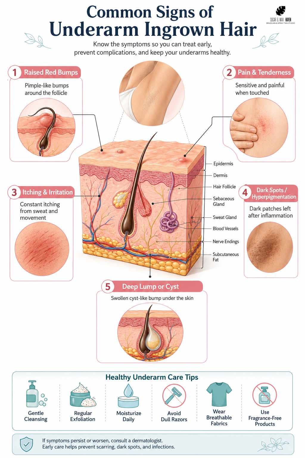 Common Signs of Underarm Ingrown Hair